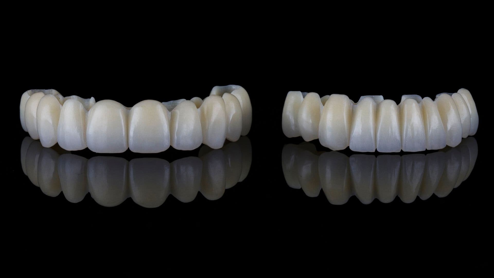 Affordable Full Mouth Rehabilitation in Rajkot for a Beautiful Smile