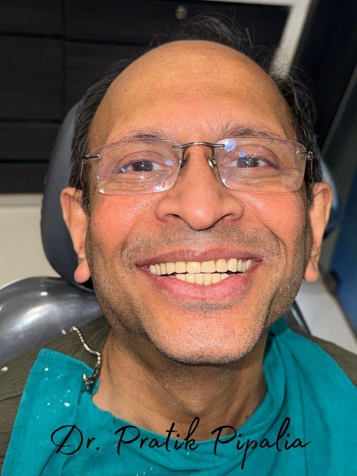 Jayeshbhai S from US after full mouth rehabilitation at Aarogyam Dental Clinic Rajkot Gujarat — dental tourism patient
