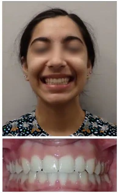 After smile treatment — facial view